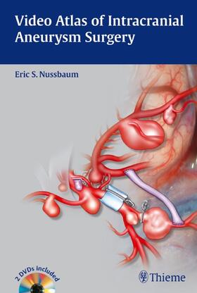 Nussbaum |  Video Atlas of Intracranial Aneurysm Surgery | eBook | Sack Fachmedien