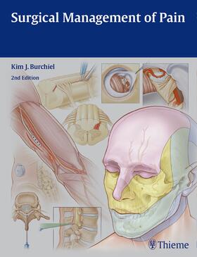 Burchiel |  Surgical Management of Pain | Buch |  Sack Fachmedien