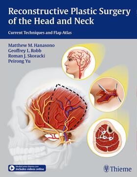 Hanasono / Robb / Skoracki |  Reconstructive Plastic Surgery of the Head and Neck | Buch |  Sack Fachmedien