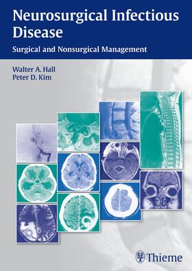 Hall / Kim |  Neurosurgical Infectious Disease | eBook | Sack Fachmedien
