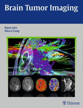 Jain / Essig |  Brain Tumor Imaging | eBook | Sack Fachmedien