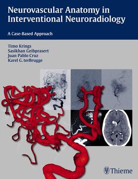 Krings / Geibprasert / ter Brugge |  Neurovascular Anatomy in Interventional Neuroradiology | Buch |  Sack Fachmedien