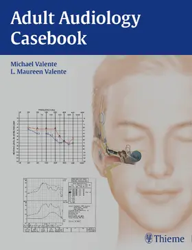 Valente |  Adult Audiology Casebook | Buch |  Sack Fachmedien