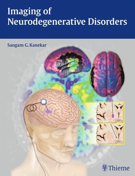 Kanekar |  Imaging of Neurodegenerative Disorders | Buch |  Sack Fachmedien