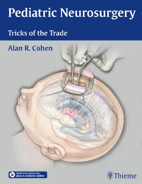 Cohen |  Pediatric Neurosurgery: Tricks of the Trade | Buch |  Sack Fachmedien