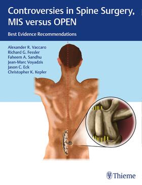Vaccaro / Fessler / Eck |  Controversies in Spine Surgery, MIS versus OPEN | Buch |  Sack Fachmedien