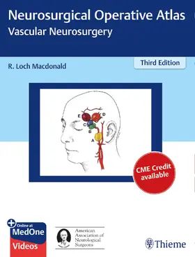 Macdonald |  Neurosurgical Operative Atlas: Vascular Neurosurgery | eBook | Sack Fachmedien