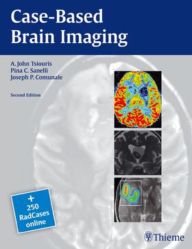 Tsiouris / Sanelli / Comunale |  Case-Based Brain Imaging | eBook | Sack Fachmedien