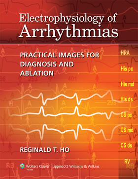 Ho |  Electrophysiology of Arrhythmias | Buch |  Sack Fachmedien