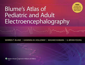 Blume / Holloway / Kaibara |  Blume's Atlas of Pediatric and Adult Electroencephalography | Buch |  Sack Fachmedien
