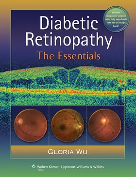 Wu |  Diabetic Retinopathy | Buch |  Sack Fachmedien