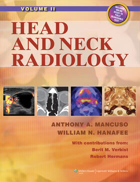 Mancuso |  Head and Neck Radiology | Buch |  Sack Fachmedien