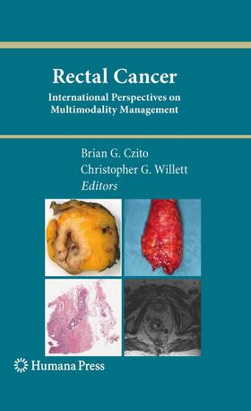 Willett / Czito |  Rectal Cancer | Buch |  Sack Fachmedien