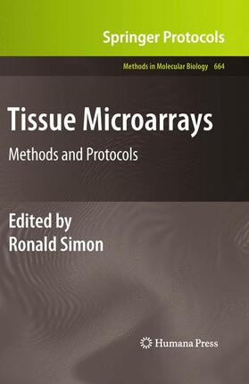 Simon |  Tissue Microarrays | Buch |  Sack Fachmedien