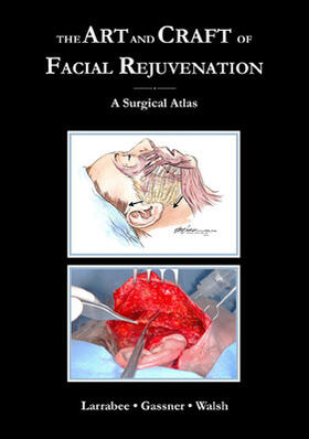 Larrabee / Gassner / Walsh |  Art & Craft of Facial Rejuvenation | Buch |  Sack Fachmedien