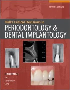 Harpenau |  Hall's Critical Decisions in Periodontology | Buch |  Sack Fachmedien