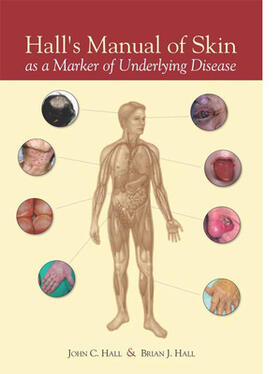 Hall |  Hall's Manual of Skin as a Marker of Underlying Disease | Buch |  Sack Fachmedien