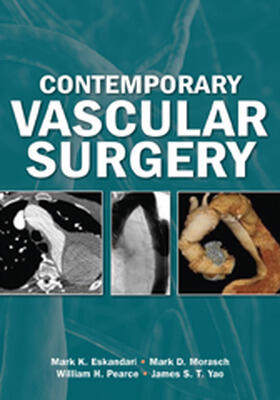 Yao / Pearce |  Contemporary Vascular Surgery | Buch |  Sack Fachmedien