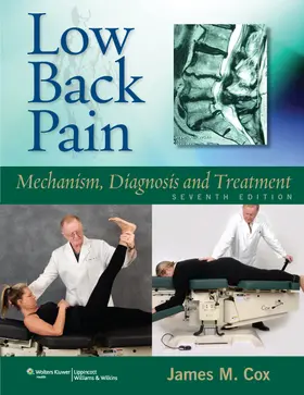 Cox |  Low Back Pain | Buch |  Sack Fachmedien