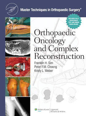 Sim / Choong / Weber |  Master Techniques in Orthopaedic Surgery: Orthopaedic Oncology and Complex Reconstruction | Buch |  Sack Fachmedien