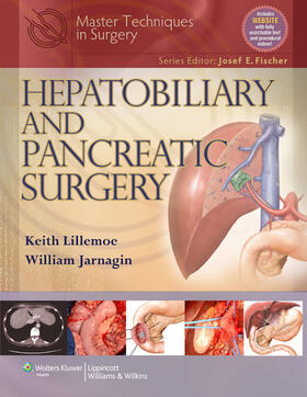 Lillemoe / Jarnigan / Jarnagin |  Master Techniques in Surgery: Hepatobiliary and Pancreatic Surgery | Buch |  Sack Fachmedien