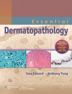 Edward / Yung |  Essential Dermatopathology | Buch |  Sack Fachmedien