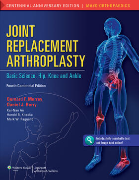 Morrey / An / Kitaoka |  Joint Replacement Arthroplasty | Buch |  Sack Fachmedien