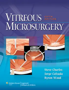 Charles / Calzada / Wood |  Vitreous Microsurgery | Buch |  Sack Fachmedien