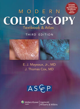 Mayeaux / American Society for Colposcopy and Cervical Pathology / Cox |  Modern Colposcopy Textbook and Atlas | Buch |  Sack Fachmedien