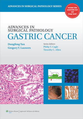 Tan / Lauwers |  Advances in Surgical Pathology: Gastric Cancer | Buch |  Sack Fachmedien