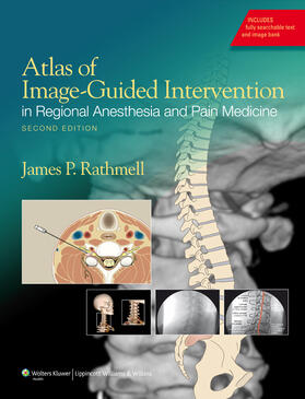 Rathmell |  Atlas of Image-Guided Intervention in Regional Anesthesia and Pain Medicine | Buch |  Sack Fachmedien