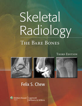 Chew | Skeletal Radiology | Buch | 978-1-60831-706-6 | sack.de