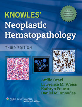 Orazi / Foucar / Knowles | Knowles Neoplastic Hematopathology | Buch | 978-1-60913-682-6 | sack.de