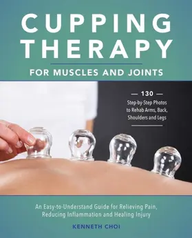 Choi |  Cupping Therapy for Muscles and Joints | eBook | Sack Fachmedien