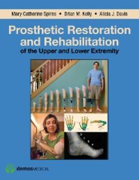 Davis / Kelly / Spires |  Prosthetic Restoration and Rehabilitation of the Upper and Lower Extremity | eBook | Sack Fachmedien