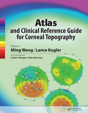 Wang / Kugler |  Atlas and Clinical Reference Guide for Corneal Topography | Buch |  Sack Fachmedien