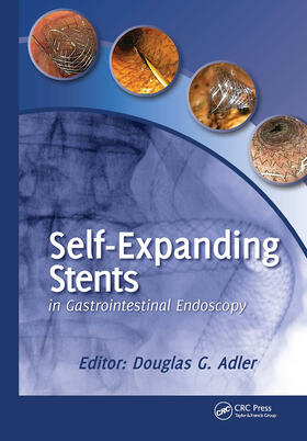 Adler |  Self-Expanding Stents in Gastrointestinal Endoscopy | Buch |  Sack Fachmedien