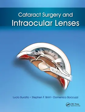 Buratto / Brint / Boccuzzi |  Cataract Surgery and Intraocular Lenses | Buch |  Sack Fachmedien