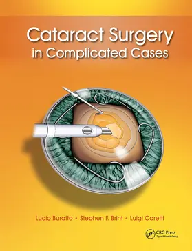 Buratto / Brint / Caretti |  Cataract Surgery in Complicated Cases | Buch |  Sack Fachmedien