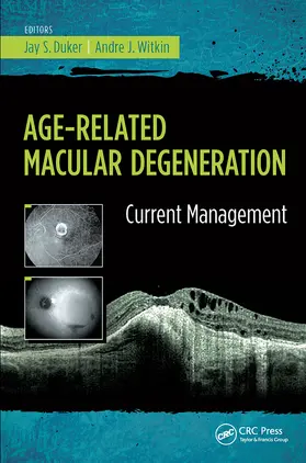 Duker / Witkin |  Age-Related Macular Degeneration | Buch |  Sack Fachmedien