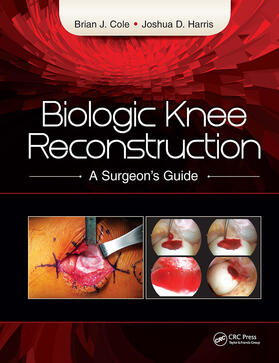 Cole / Harris |  Biologic Knee Reconstruction | Buch |  Sack Fachmedien