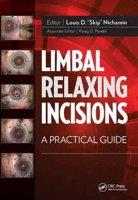 Nichamin |  Limbal Relaxing Incisions | Buch |  Sack Fachmedien