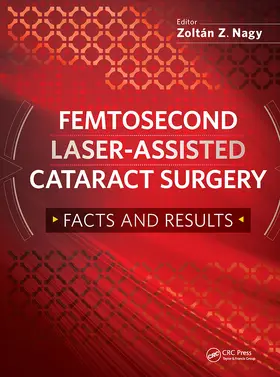 Nagy |  Femtosecond Laser-Assisted Cataract Surgery | Buch |  Sack Fachmedien