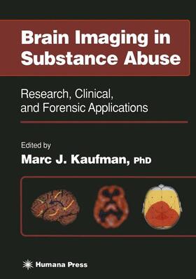 Kaufman |  Brain Imaging in Substance Abuse | Buch |  Sack Fachmedien