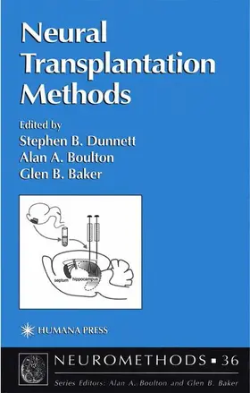 Dunnett / Baker / Boulton |  Neural Transplantation Methods | Buch |  Sack Fachmedien