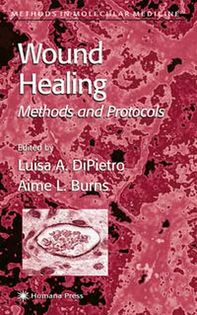 Burns / DiPietro |  Wound Healing | Buch |  Sack Fachmedien