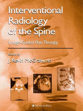 McGraw |  Interventional Radiology of the Spine | Buch |  Sack Fachmedien