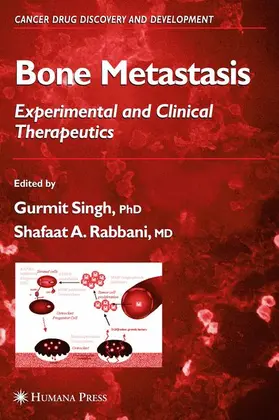 Rabbani / Singh |  Bone Metastasis | Buch |  Sack Fachmedien