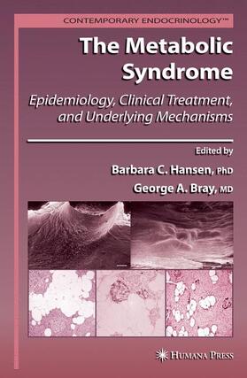 Bray / Hansen |  The Metabolic Syndrome: | Buch |  Sack Fachmedien