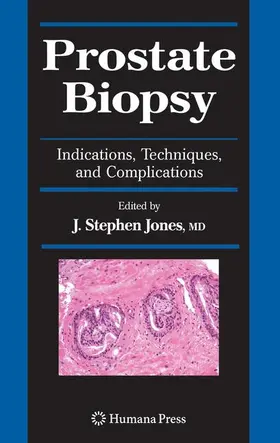 Jones |  Prostate Biopsy | Buch |  Sack Fachmedien